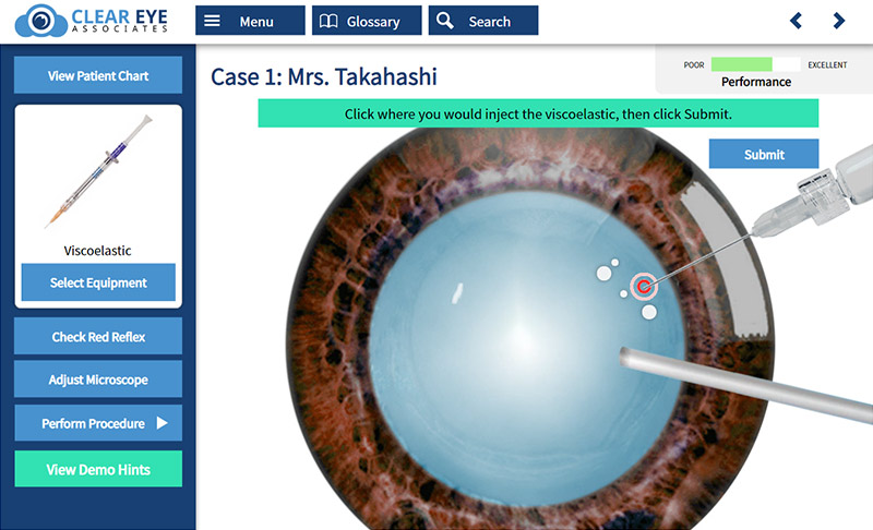 Eye Surgery Practice Elearning Example SmartBuilder